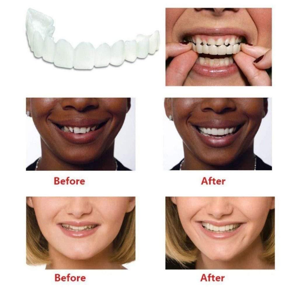 Fit Flex Cosmetic Teeth